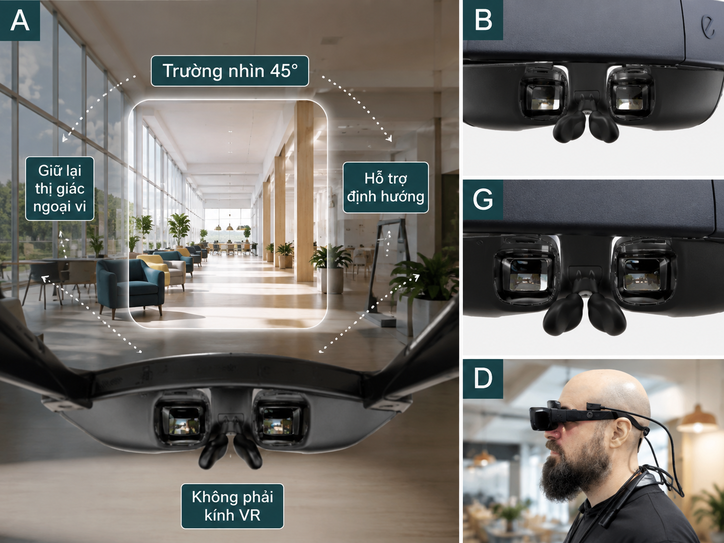 eSight Go